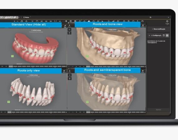 As maiores tendências da ortodontia para 2023: o que esperar